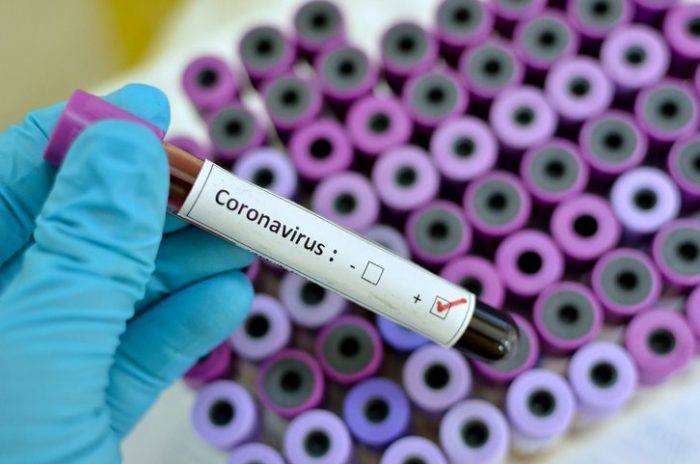 158 de cazuri de coronavirus în România